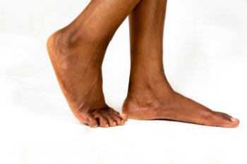 Treatment Options for Flat Feet